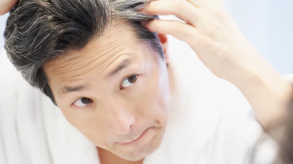 Hair Transplants Explained: How Modern Techniques Are Restoring Confidence?